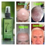 Neo Hair Lotion 120 ml - Image 4