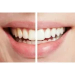 360° Spin Smile - Image 3