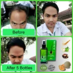 Neo Hair Lotion 120 ml - Image 7