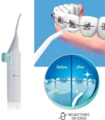 Dental Water Flosser - Image 5