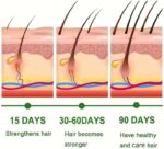 Rozino Rosemary Oil | زيت إكليل الجبل - Image 3