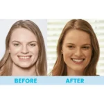 360° Spin Smile - Image 2