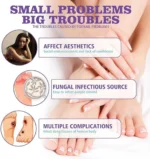 Nail Fungus Spray - Image 6
