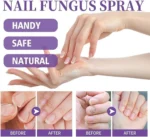 Nail Fungus Spray - Image 2