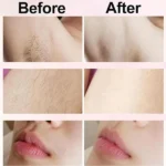 Double Head Shaver & Trimmer - Ipx7 Waterproof Wet & Dry Use (for bikini, underarms, legs, arms, body & face) (مِقَص حلاقة كهربائي ذوا رأسين) - Image 5
