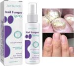 Nail Fungus Spray - Image 3