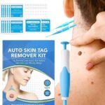 Acrochordon Skin Remover Kit
