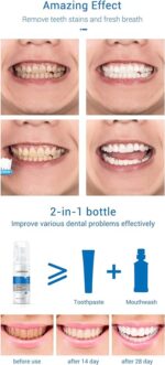 Teeth Whitening Mousse - Image 4