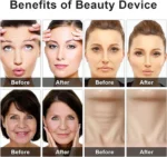 Eye Beauty Device - Image 5