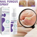 Nail Fungus Spray - Image 5