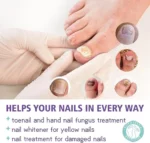 Nail Fungus Spray - Image 7