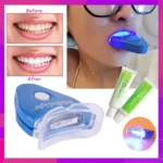 Tooth Whitening System - Image 3