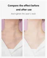Anti Wrinkle Beauty Apparatus - Image 2